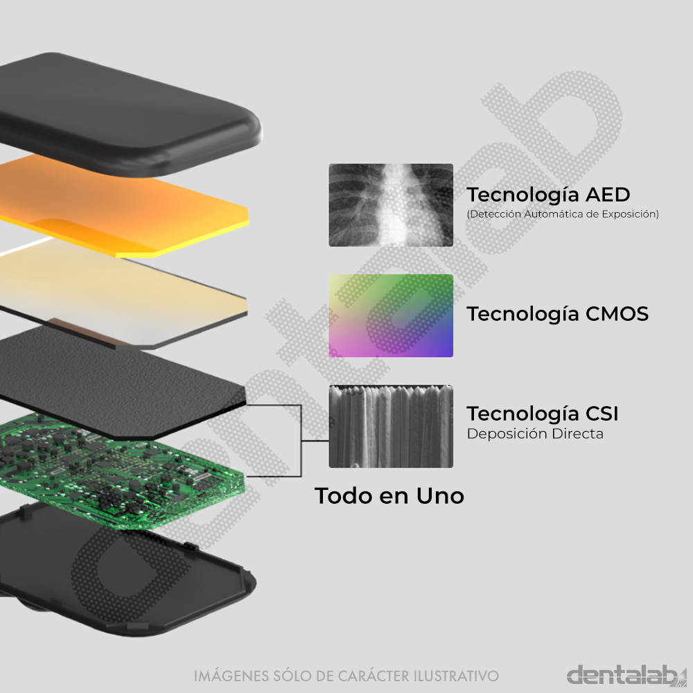 Sistema Radiográfico Digital Eighteeth • RVG • Nanopix 1 • sin Posicionador
