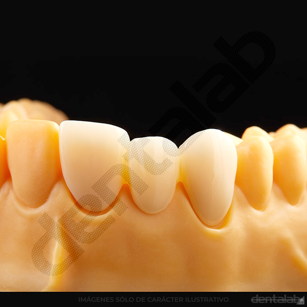 Disco de Zirconio  RONDCERA SHT-ML PRO 3D C3 98 X 14mm